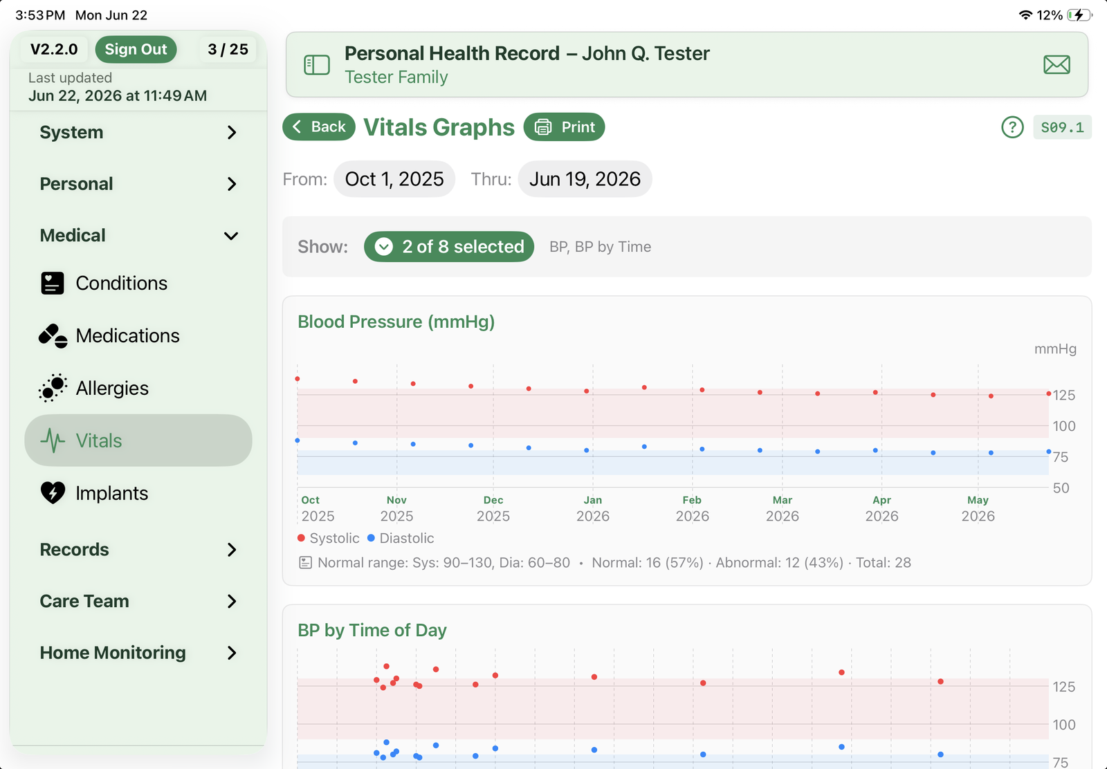 Vitals Graphs